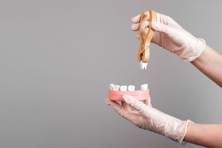 ¿Qué es la alveolitis y cómo tratarla? - Adeslas Dental