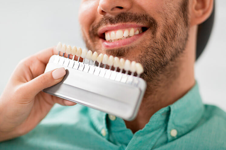 Escala de color de les dents: quants blancs hi ha